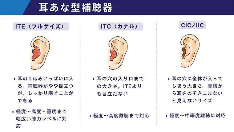 耳あな型補聴器