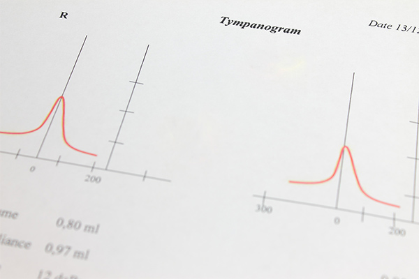 いくつかの検査により、難聴の原因である中耳の機能障害を調べることができます。